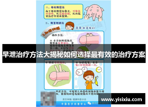早泄治疗方法大揭秘如何选择最有效的治疗方案